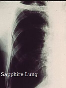 Sapphire Lung cover art