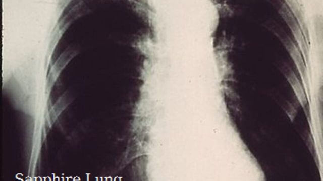 Sapphire Lung screenshot 1